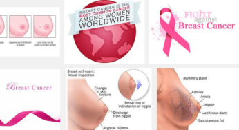 BREAST CANCER IS MORE ADVANCED IN BLACK WOMEN!