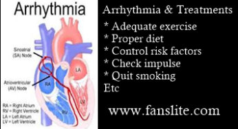 Arrhythmia Treatment: About Arrhythmia & Arrhythmia Treatment In USA